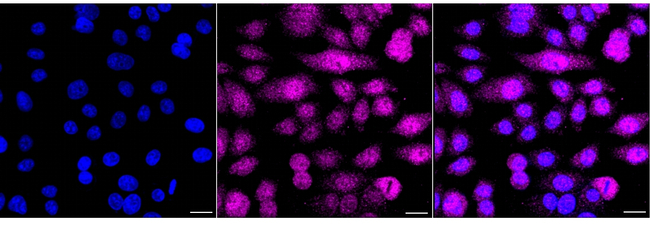 ATP6V1A Antibody in Immunocytochemistry (ICC/IF)