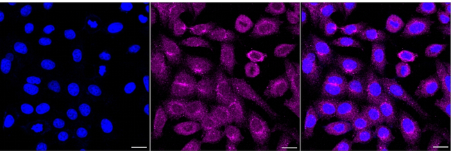CAB39 Antibody in Immunocytochemistry (ICC/IF)