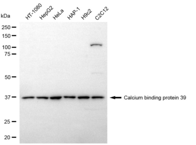 CAB39 Antibody in Western Blot (WB)