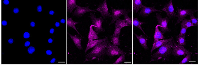 CAPG Antibody in Immunocytochemistry (ICC/IF)