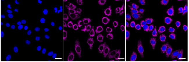 CBR1 Antibody in Immunocytochemistry (ICC/IF)