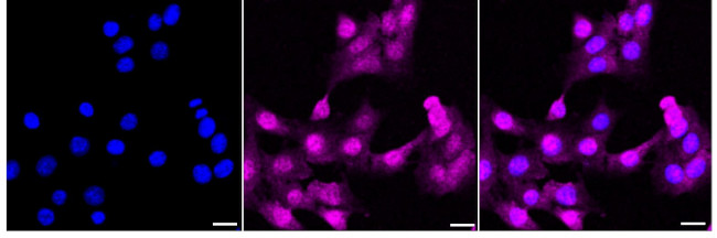 CBR1 Antibody in Immunocytochemistry (ICC/IF)
