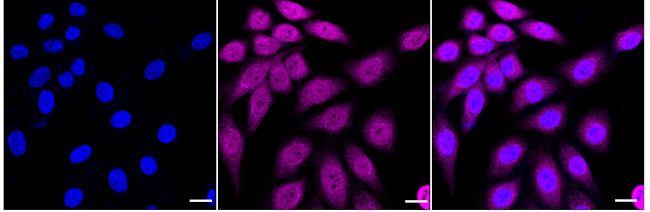 TCP-1 beta Antibody in Immunocytochemistry (ICC/IF)