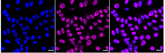 CUGBP1 Antibody in Immunocytochemistry (ICC/IF)