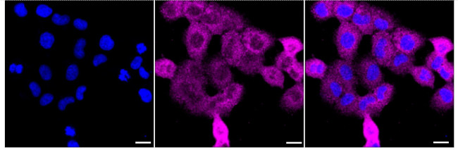 CARS Antibody in Immunocytochemistry (ICC/IF)