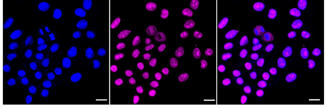 DHX9 Antibody in Immunocytochemistry (ICC/IF)