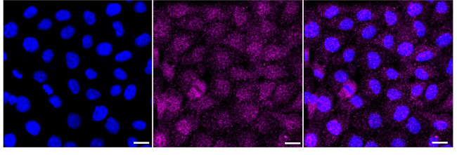 DPYSL3 Antibody in Immunocytochemistry (ICC/IF)