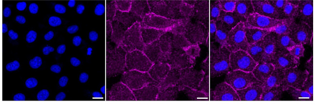 SAP97 Antibody in Immunocytochemistry (ICC/IF)