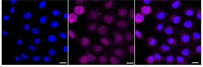DCTN5 Antibody in Immunocytochemistry (ICC/IF)