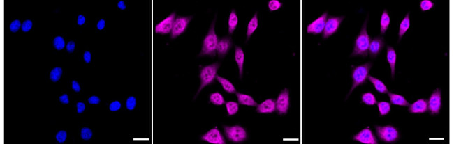 Endothelin B Receptor Antibody in Immunocytochemistry (ICC/IF)