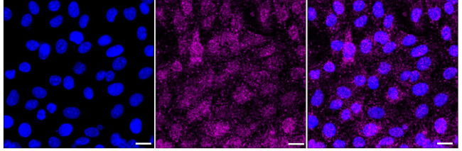 Follistatin Antibody in Immunocytochemistry (ICC/IF)