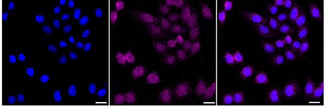 GFPT1 Antibody in Immunocytochemistry (ICC/IF)