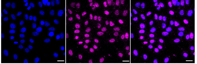 GluR6 Antibody in Immunocytochemistry (ICC/IF)