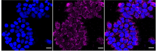 HLA-F Antibody in Immunocytochemistry (ICC/IF)
