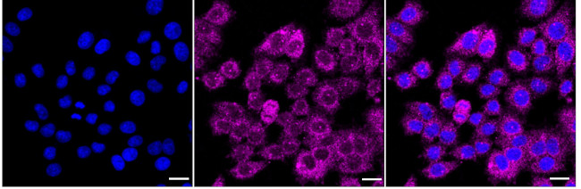 Kallikrein 2 Antibody in Immunocytochemistry (ICC/IF)