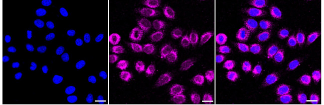 KLC3 Antibody in Immunocytochemistry (ICC/IF)