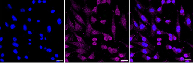 LTB4R Antibody in Immunocytochemistry (ICC/IF)