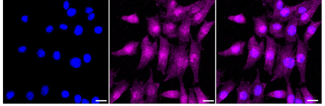 LHX3 Antibody in Immunocytochemistry (ICC/IF)