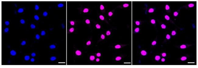 MAdCAM-1 Antibody in Immunocytochemistry (ICC/IF)