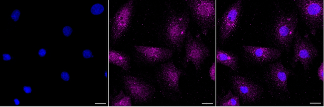 LC3B Antibody in Immunocytochemistry (ICC/IF)