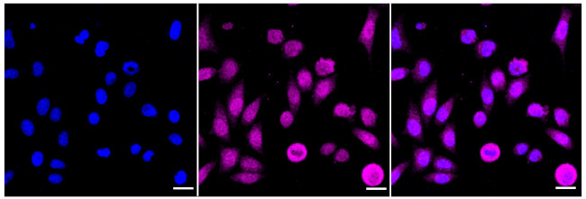 MEK3/MEK6 Antibody in Immunocytochemistry (ICC/IF)
