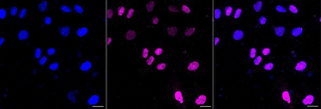 MEF2A/MEF2C Antibody in Immunocytochemistry (ICC/IF)