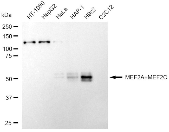 MEF2A/MEF2C Antibody in Western Blot (WB)