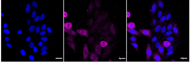 MELK Antibody in Immunocytochemistry (ICC/IF)