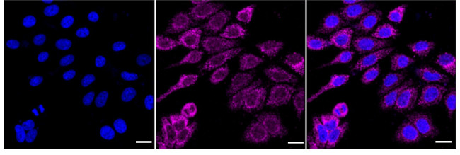 MTCO2 Antibody in Immunocytochemistry (ICC/IF)