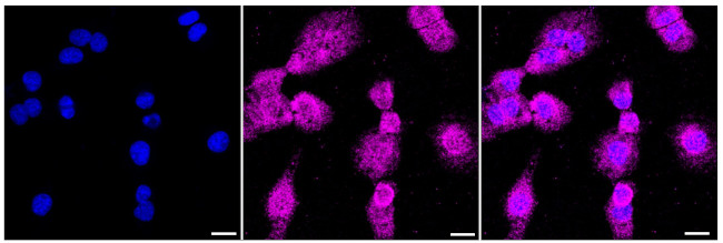 MBNL1 Antibody in Immunocytochemistry (ICC/IF)
