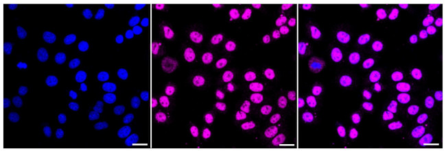 MEF2A Antibody in Immunocytochemistry (ICC/IF)