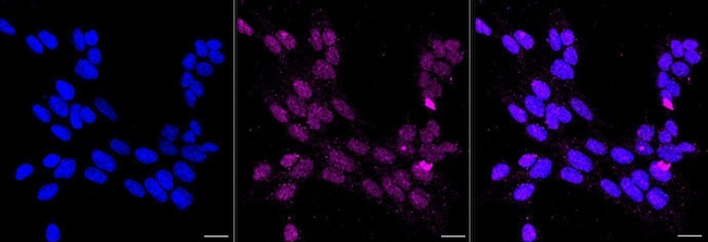 MYF5 Antibody in Immunocytochemistry (ICC/IF)