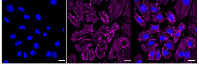MRLC2 Antibody in Immunocytochemistry (ICC/IF)
