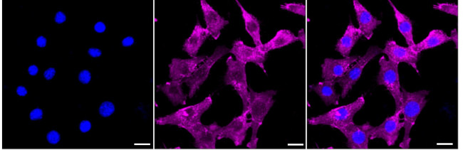 NPR3 Antibody in Immunocytochemistry (ICC/IF)