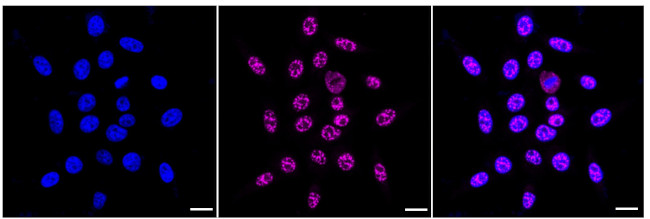 NDUFC2 Antibody in Immunocytochemistry (ICC/IF)