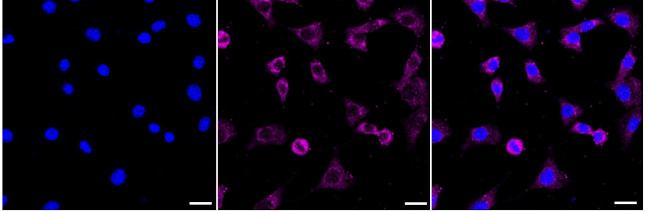 NDUFS2 Antibody in Immunocytochemistry (ICC/IF)