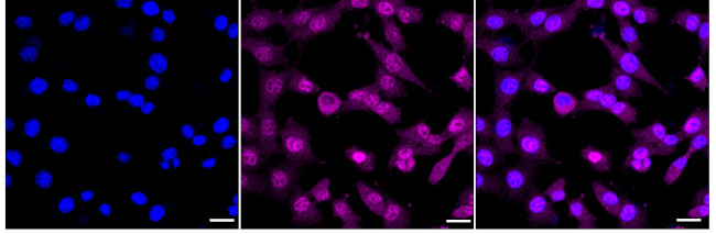 N4BP1 Antibody in Immunocytochemistry (ICC/IF)
