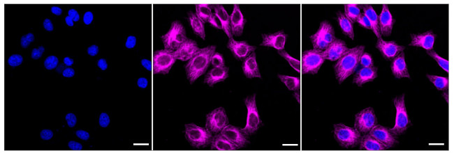 NPY5R Antibody in Immunocytochemistry (ICC/IF)