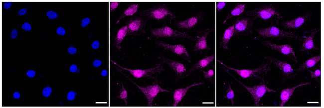 NFE2 Antibody in Immunocytochemistry (ICC/IF)