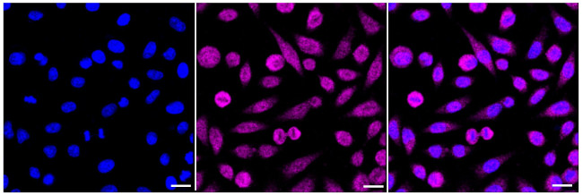 IkB beta Antibody in Immunocytochemistry (ICC/IF)