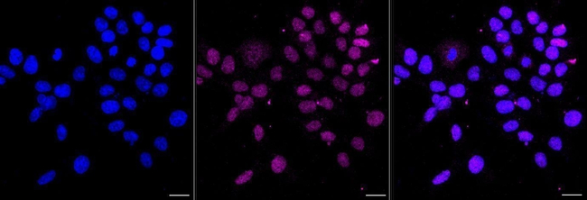 Nkx2.2 Antibody in Immunocytochemistry (ICC/IF)