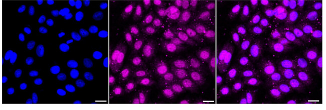 NME2 Antibody in Immunocytochemistry (ICC/IF)