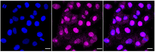 NMI Antibody in Immunocytochemistry (ICC/IF)