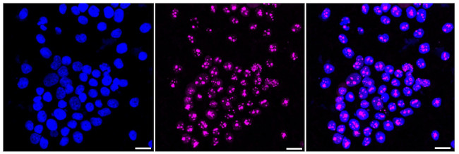 NOLC1 Antibody in Immunocytochemistry (ICC/IF)