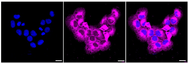 NPC1 Antibody in Immunocytochemistry (ICC/IF)