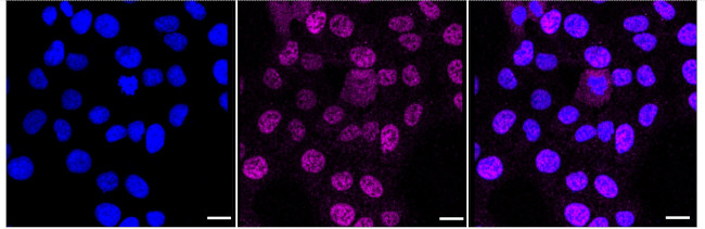 TLX Antibody in Immunocytochemistry (ICC/IF)