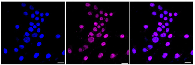 NR2F1 Antibody in Immunocytochemistry (ICC/IF)