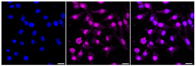 NUP107 Antibody in Immunocytochemistry (ICC/IF)