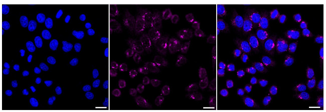 NUDT19 Antibody in Immunocytochemistry (ICC/IF)