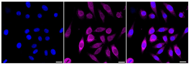 P4HTM Antibody in Immunocytochemistry (ICC/IF)